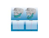 ROMEXIS 4D JAW MOTION
